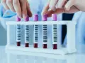 Ręce w białej rękawiczce zamykają probówki z próbkami krwi. Każda probówka ma kod kreskowy, który może być użyty do identyfikacji próbek, np. w badaniach rdw-sd.