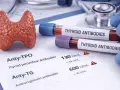 Model tarczycy obok probówek z napisem "THYROID ANTIBODIES" i wynikiem badania anty-TPO.