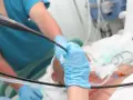 Lekarz wykonuje bronchoskopię, wprowadzając endoskop do dróg oddechowych pacjenta. Procedura ta pozwala ocenić stan płuc.