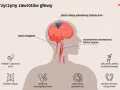 Ilustracja przedstawia przyczyny zawrotów głowy: zablokowanie tętnicy szyjnej, infekcje ucha, choroby mózgu, zaburzenia metaboliczne i sercowo-naczyniowe.