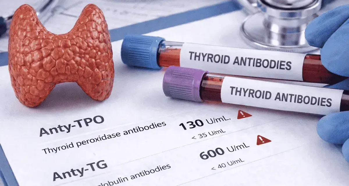 Model tarczycy obok probówek z napisem "THYROID ANTIBODIES" i wynikiem badania anty-TPO.