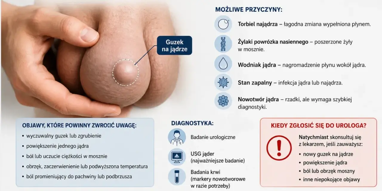 Guzek na jądrze, który może oznaczać różne rzeczy, od łagodnych zmian po nowotwór. Ból lub uczucie ciężkości w mosznie to jeden z objawów.