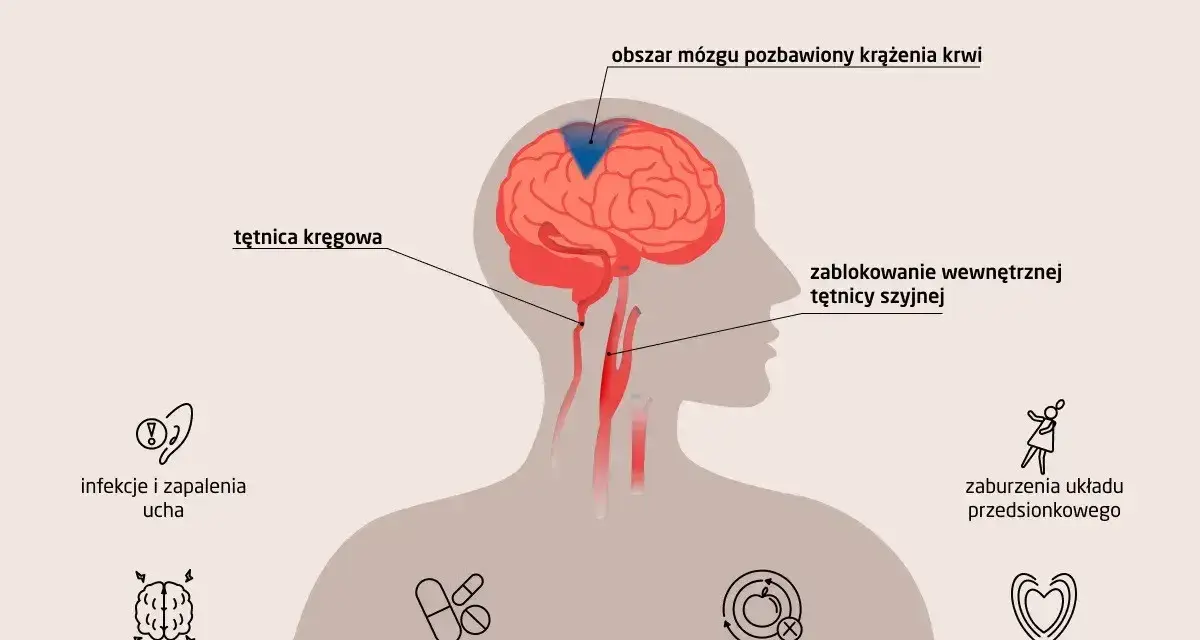 Ilustracja przedstawia przyczyny zawrotów głowy: zablokowanie tętnicy szyjnej, infekcje ucha, choroby mózgu, zaburzenia metaboliczne i sercowo-naczyniowe.