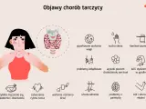 Ilustracja pokazuje, gdzie jest tarczyca, i objawy jej chorób: zmęczenie, problemy z wagą, skórą, paznokciami, sercem, włosami i pamięcią.