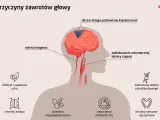 Ilustracja przedstawia przyczyny zawrotów głowy: zablokowanie tętnicy szyjnej, infekcje ucha, choroby mózgu, zaburzenia metaboliczne i sercowo-naczyniowe.