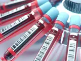 Probówki z krwią w wirówce laboratoryjnej. To standardowe badanie krwi, które pomaga zdiagnozować wiele schorzeń.