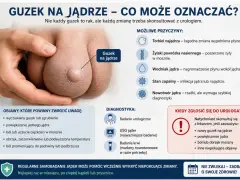 Guzek na jądrze, który może oznaczać różne rzeczy, od łagodnych zmian po nowotwór. Ból lub uczucie ciężkości w mosznie to jeden z objawów.