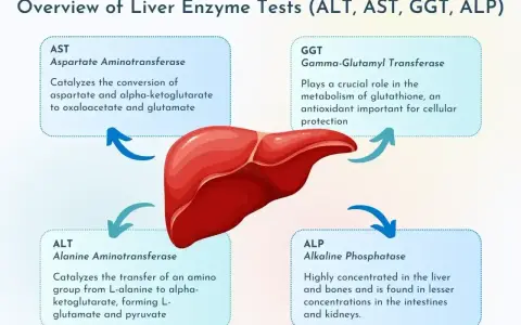Schemat przedstawia enzymy wątrobowe: ALT, AST, GGT, ALP. AST to aspartaminotransferaza, kluczowa dla metabolizmu.