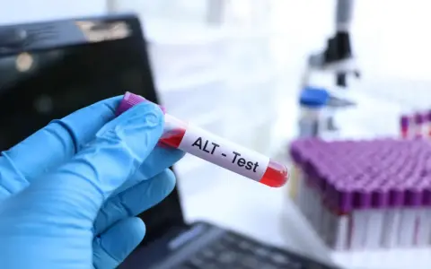 Ręka w niebieskiej rękawiczce trzyma probówkę z krwią oznaczoną "ALT - Test". W tle mikroskop i stojak z próbkami. To badanie ALT.