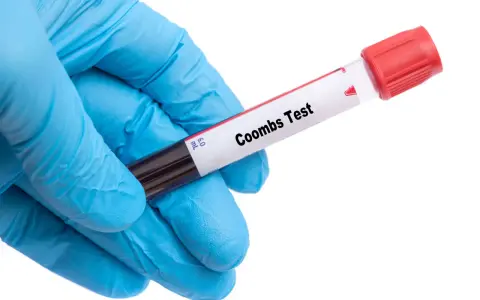 Rękawiczka medyczna trzyma probówkę z krwią do badania. Na etykiecie widnieje napis "Coombs Test", wskazujący na wykonanie odczynu Coombsa.