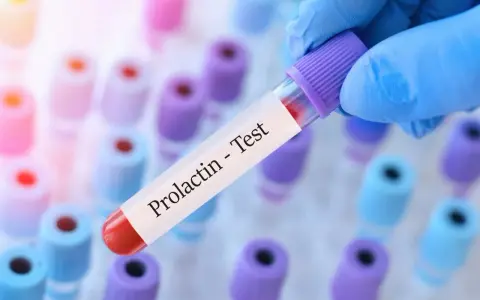 Ręka w niebieskiej rękawiczce trzyma probówkę z napisem "Prolactin - Test". Kiedy badać prolaktynę? To pytanie często zadawane przez pacjentów.