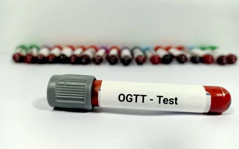 Probówka z oznaczeniem OGTT - Test na tle wielu innych próbek krwi.