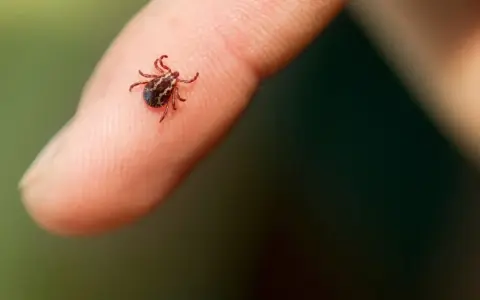 Mały, ciemny pajęczak, zdrapany kleszcz, siedzi na opuszce palca.