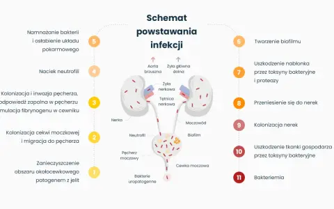 Schemat powstawania infekcji, od zanieczyszczenia do zapalenia pęcherza i nerek. Bakterie uropatogenne kolonizują cewkę moczową, pęcherz, a następnie nerki.