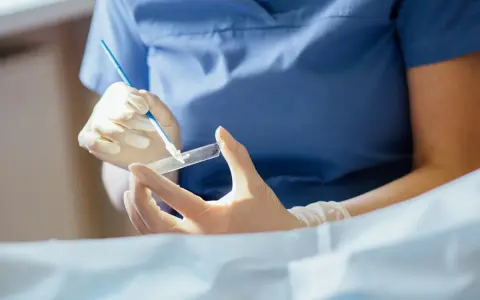 Ręce w rękawiczkach przygotowują próbkę do badania. To kluczowy etap, by dowiedzieć się, cytologia co to i jak działa.