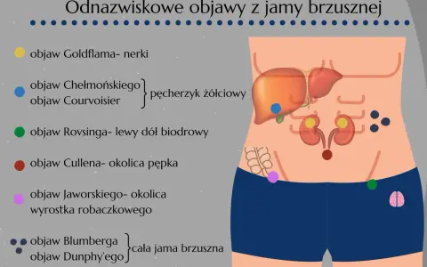 Objaw Rovsinga zaznaczony zieloną kropką w lewym dole biodrowym, ilustrujący objawy z jamy brzusznej.