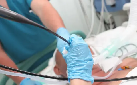 Lekarz w niebieskich rękawiczkach wykonuje bronchoskopię, wprowadzając endoskop do dróg oddechowych pacjenta podłączonego do aparatury medycznej.