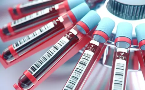 Probówki z krwią w wirówce laboratoryjnej. To standardowe badanie krwi, które pomaga zdiagnozować wiele schorzeń.