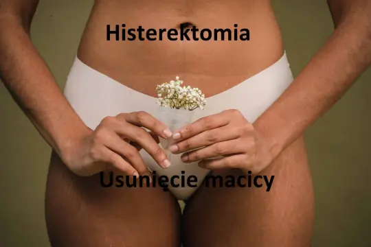 Kobieta trzymająca kubeczek menstruacyjny z kwiatami. Napisy "Histerektomia" i "Usunięcie macicy" sugerują temat.