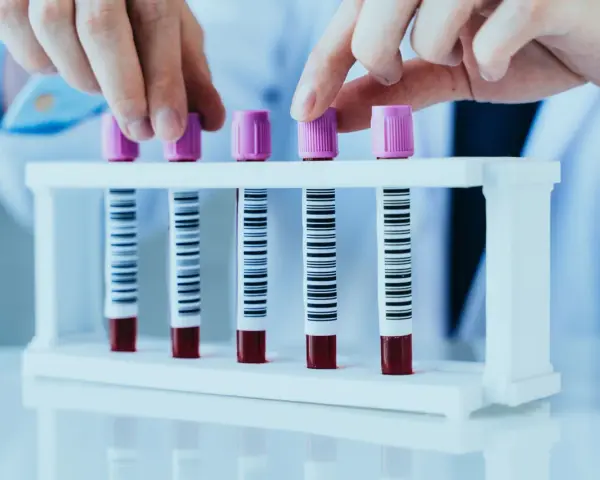 Ręce w białej rękawiczce zamykają probówki z próbkami krwi. Każda probówka ma kod kreskowy, który może być użyty do identyfikacji próbek, np. w badaniach rdw-sd.