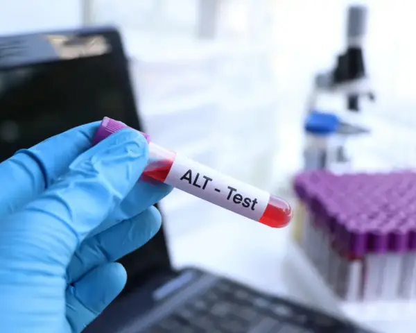 Ręka w niebieskiej rękawiczce trzyma probówkę z krwią oznaczoną "ALT - Test". W tle mikroskop i stojak z próbkami. To badanie ALT.