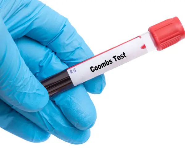 Rękawiczka medyczna trzyma probówkę z krwią do badania. Na etykiecie widnieje napis "Coombs Test", wskazujący na wykonanie odczynu Coombsa.