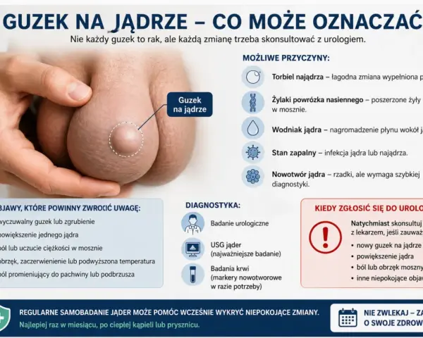 Guzek na jądrze, który może oznaczać różne rzeczy, od łagodnych zmian po nowotwór. Ból lub uczucie ciężkości w mosznie to jeden z objawów.