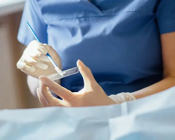 Ręce w rękawiczkach przygotowują próbkę do badania. To kluczowy etap, by dowiedzieć się, cytologia co to i jak działa.
