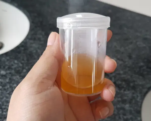 Próbka moczu z widocznymi fosforanami bezpostaciowymi.