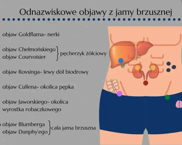 Objaw Jaworskiego lokalizuje się w okolicy wyrostka robaczkowego. Ilustracja pokazuje różne objawy brzuszne.