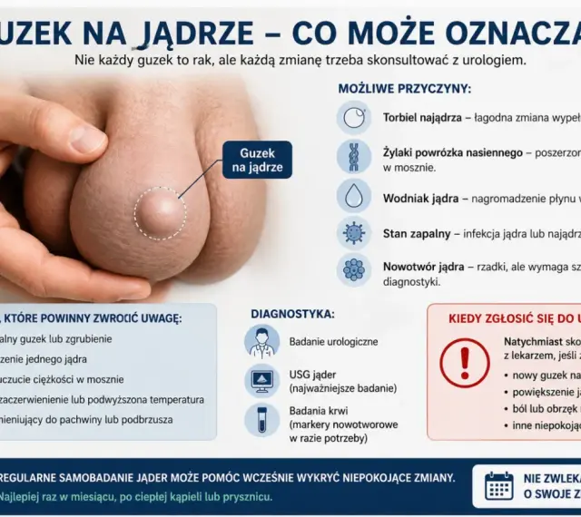 Guzek na jądrze, który może oznaczać różne rzeczy, od łagodnych zmian po nowotwór. Ból lub uczucie ciężkości w mosznie to jeden z objawów.