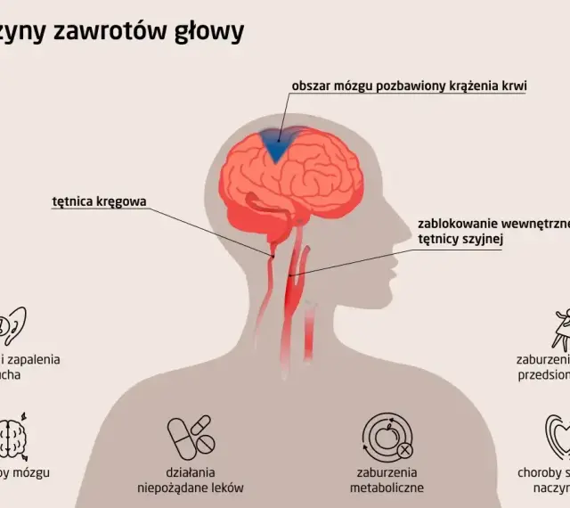 Ilustracja przedstawia przyczyny zawrotów głowy: zablokowanie tętnicy szyjnej, infekcje ucha, choroby mózgu, zaburzenia metaboliczne i sercowo-naczyniowe.