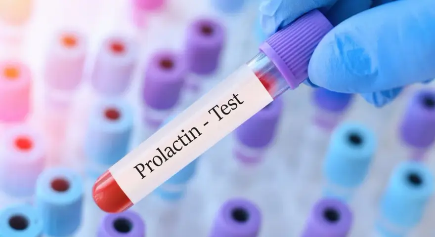Ręka w niebieskiej rękawiczce trzyma probówkę z napisem "Prolactin - Test". Kiedy badać prolaktynę? To pytanie często zadawane przez pacjentów.