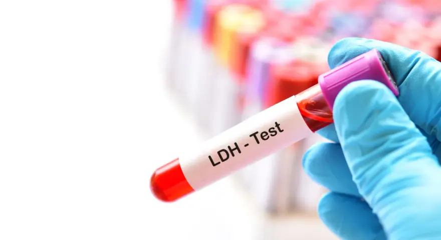 Ręka w niebieskiej rękawiczce trzyma probówkę z krwią do testu LDH. W tle widać wiele innych probówek.