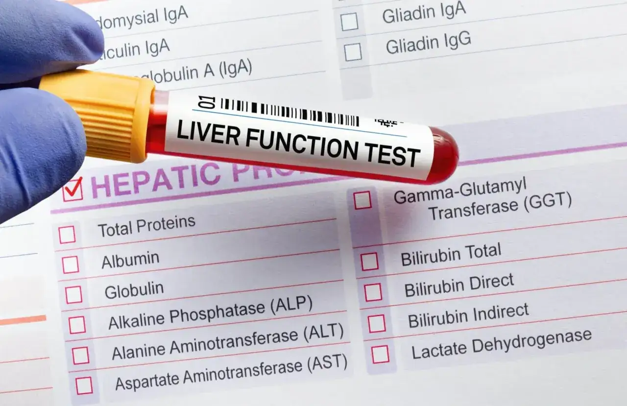 Próbka krwi do badania funkcji wątroby (Liver Function Test). Na formularzu widoczne parametry: białka, albuminy, bilirubina, GGT.