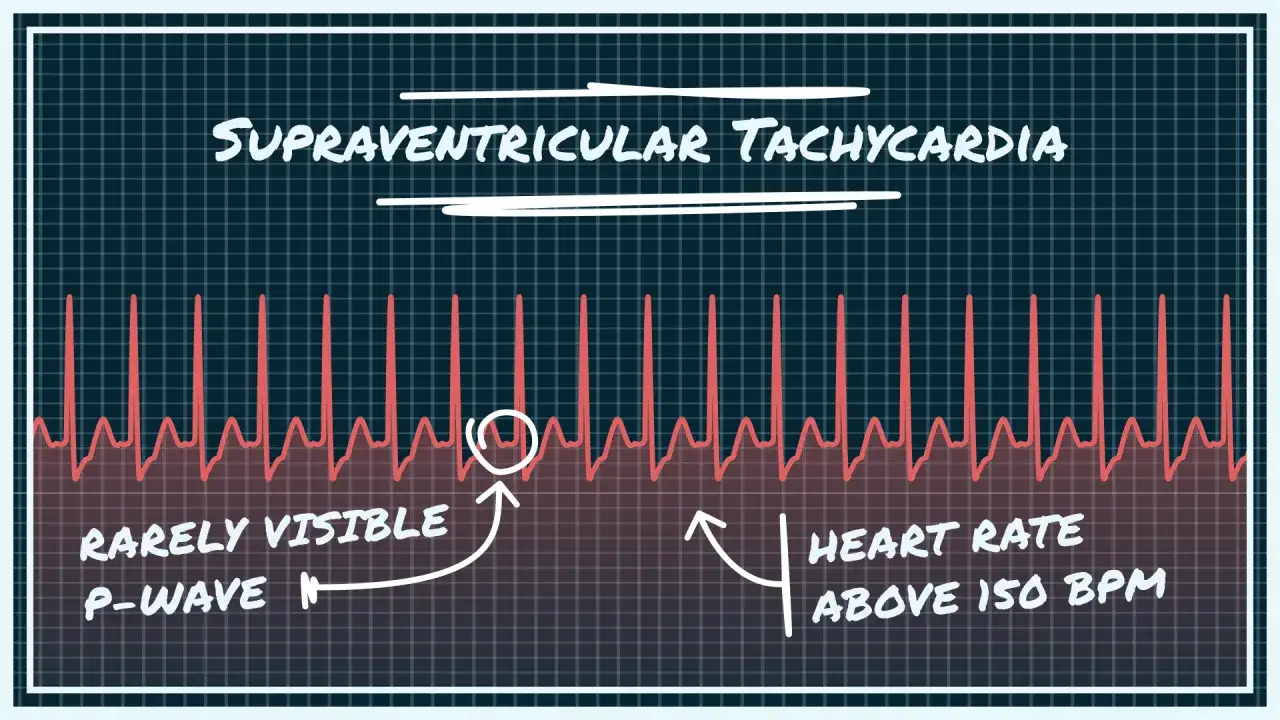 EKG z napisem 