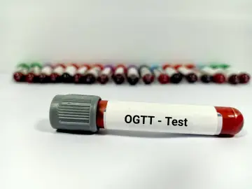 Probówka z oznaczeniem OGTT - Test na tle wielu innych próbek krwi.