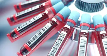 Probówki z krwią w wirówce laboratoryjnej. To standardowe badanie krwi, które pomaga zdiagnozować wiele schorzeń.