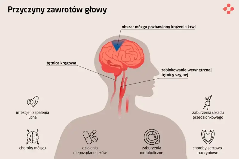 Ilustracja przedstawia przyczyny zawrotów głowy: zablokowanie tętnicy szyjnej, infekcje ucha, choroby mózgu, zaburzenia metaboliczne i sercowo-naczyniowe.