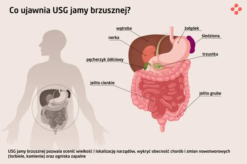 USG jamy brzusznej co wykrywa: wątrobę, nerki, żołądek, jelita, pęcherzyk żółciowy, trzustkę, śledzionę. Pomaga ocenić narządy i wykryć choroby.